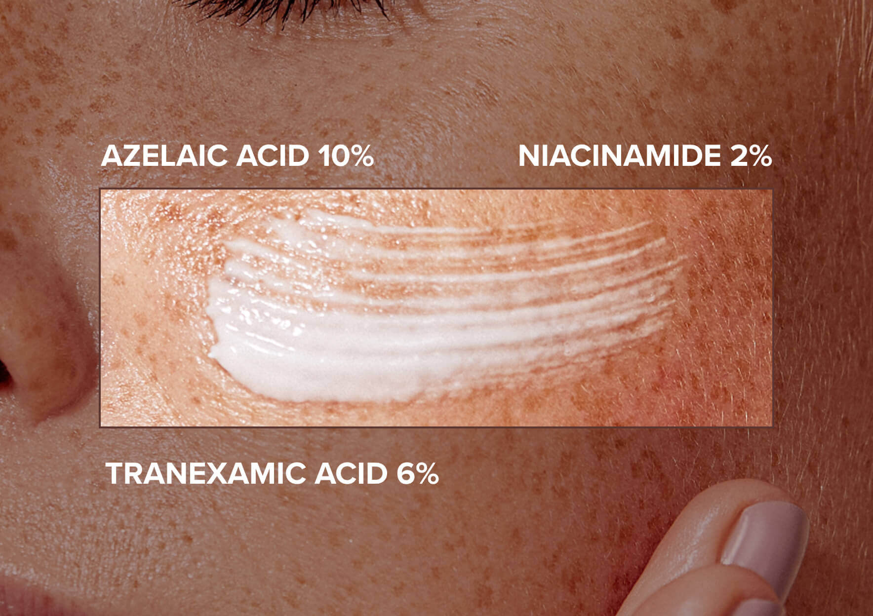 Melzara 30gm Cream - Image 2